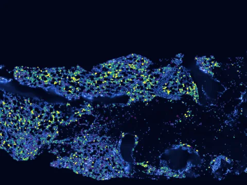 Human bone marrow preview