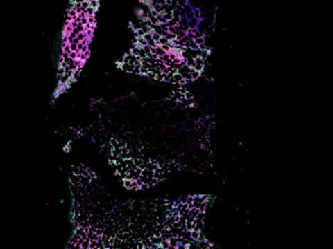 Human bone marrow preview