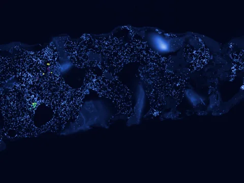 Human bone marrow preview