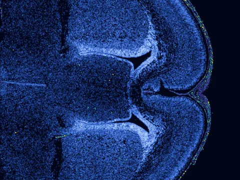 Mouse brain preview