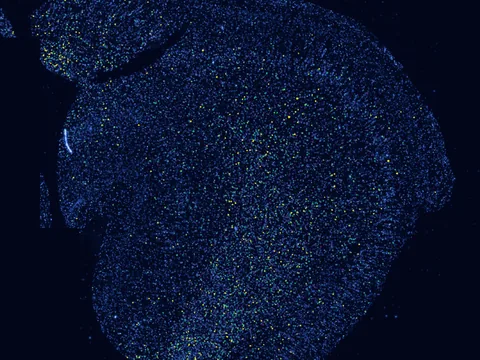 Human brain preview