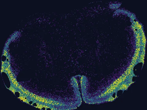 Mouse brain preview