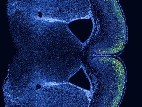 Mouse brain preview