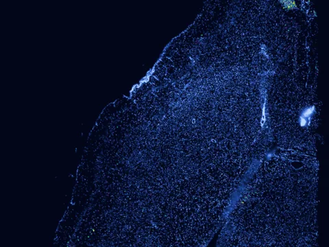 Mouse brain preview