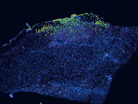 Mouse brain preview