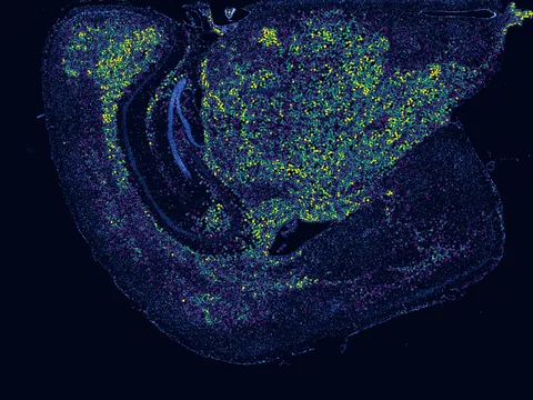 Mouse brain preview