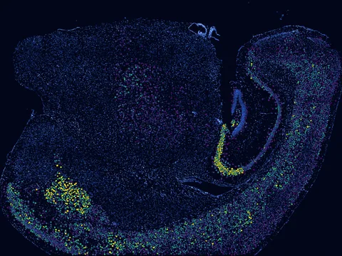 Mouse brain preview