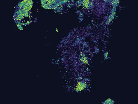 Human brain preview