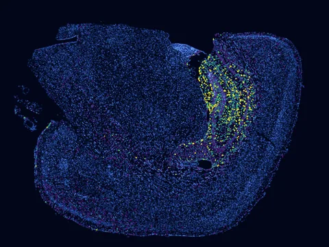 Mouse brain preview