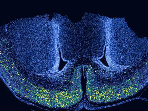 Mouse brain preview