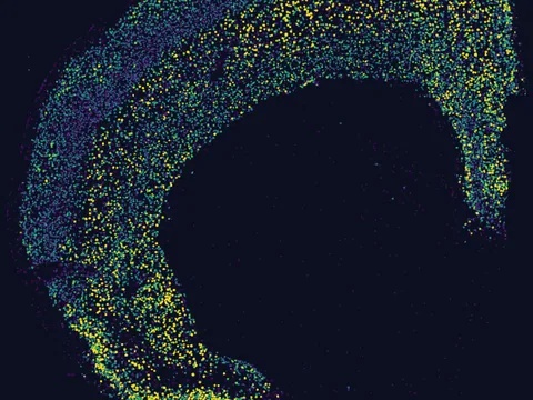 Mouse brain preview