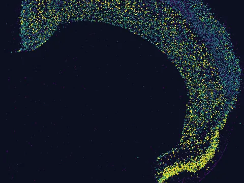 Mouse brain preview