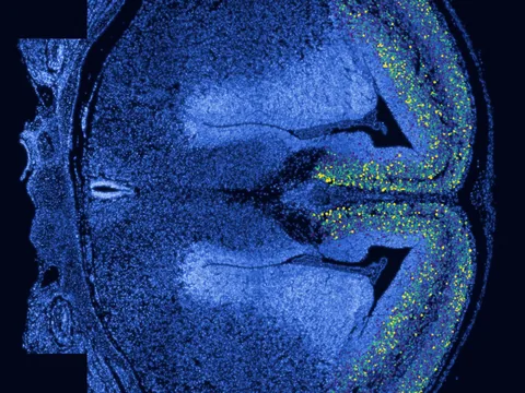 Mouse brain preview