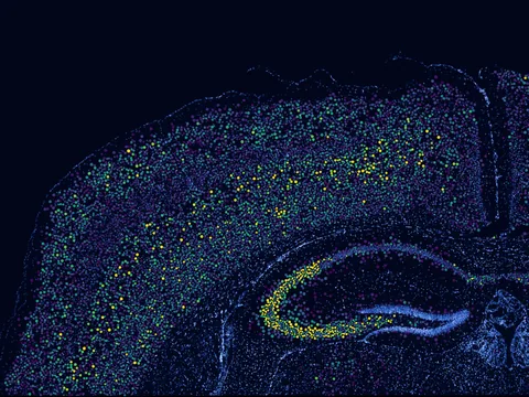 Mouse brain preview