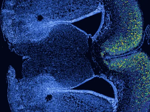 Mouse brain preview