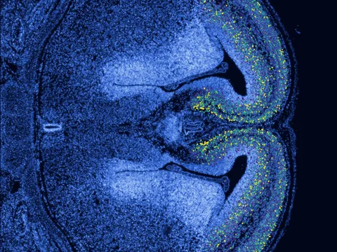 Mouse brain preview
