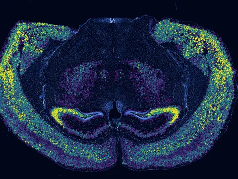 Mouse brain preview