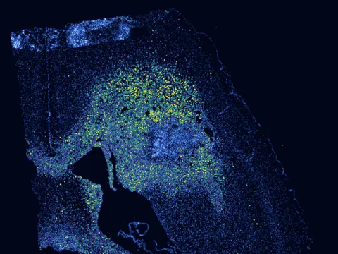 Mouse brain preview