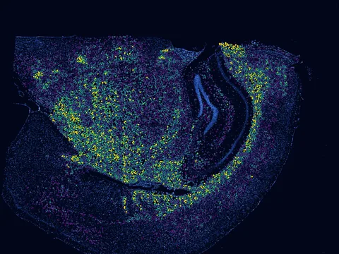 Mouse brain preview