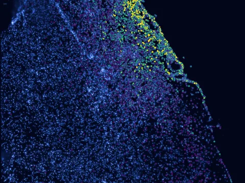 Mouse brain preview