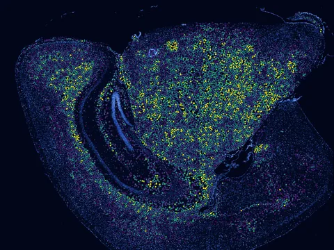 Mouse brain preview