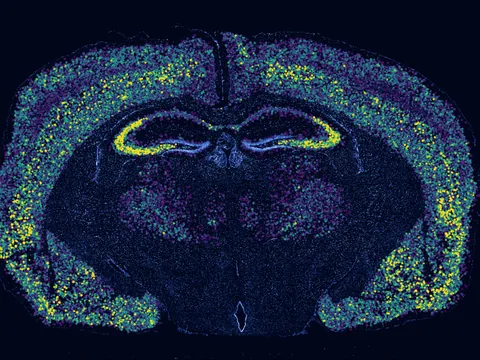 Mouse brain preview
