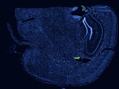 Mouse brain preview