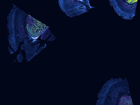 Mouse brain preview