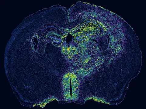 Mouse brain preview