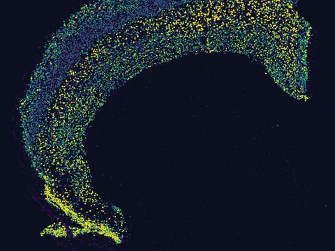 Mouse brain preview