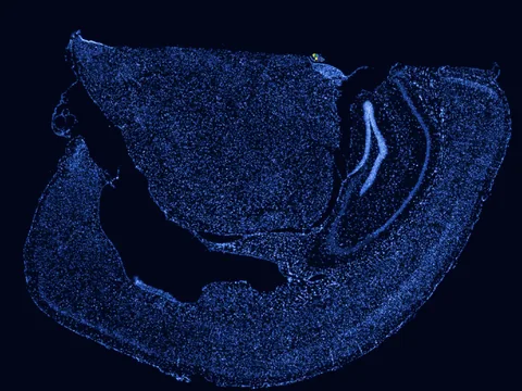 Mouse brain preview