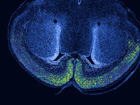 Mouse brain preview