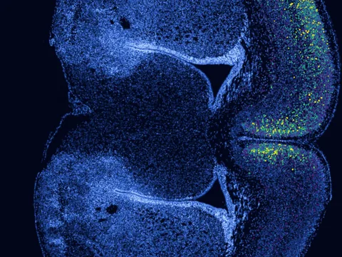 Mouse brain preview