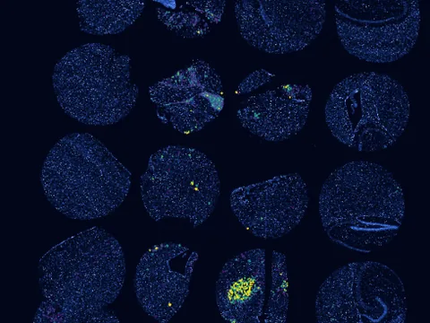 Mouse brain preview