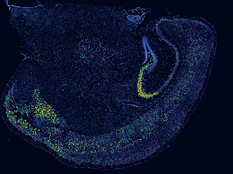 Mouse brain preview