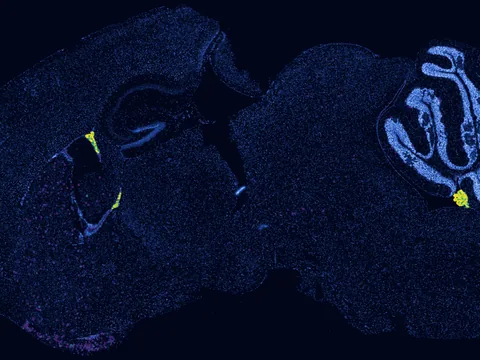 Mouse brain preview