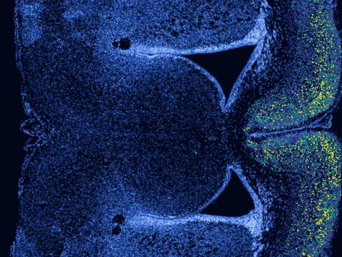 Mouse brain preview