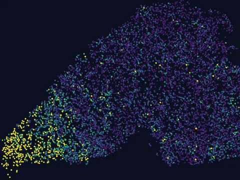 Human brain preview
