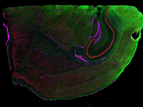 Mouse brain preview