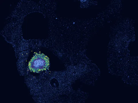 Human brain preview