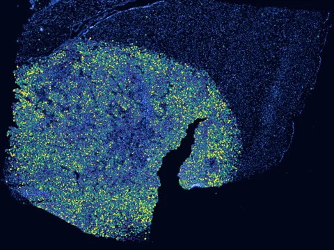 Mouse brain preview