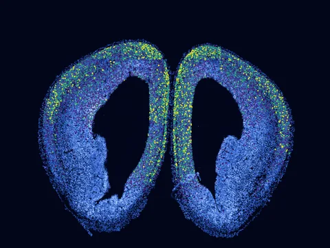 Mouse brain preview