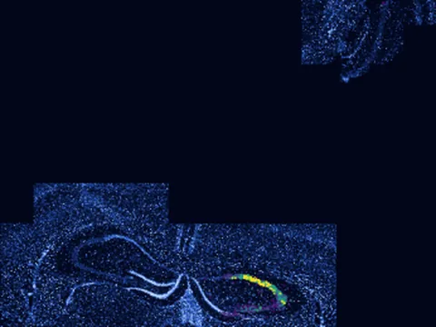 Mouse brain preview
