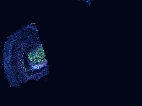 Mouse brain preview