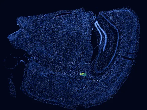 Mouse brain preview