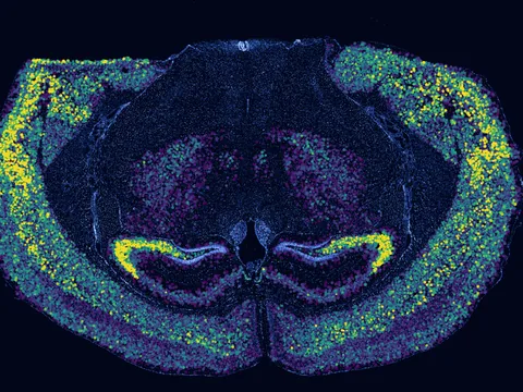 Mouse brain preview