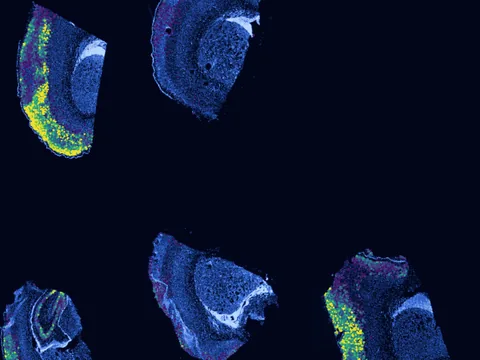 Mouse brain preview