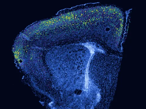 Mouse brain preview