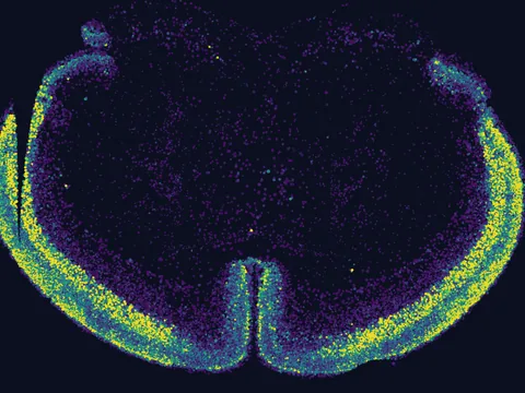 Mouse brain preview
