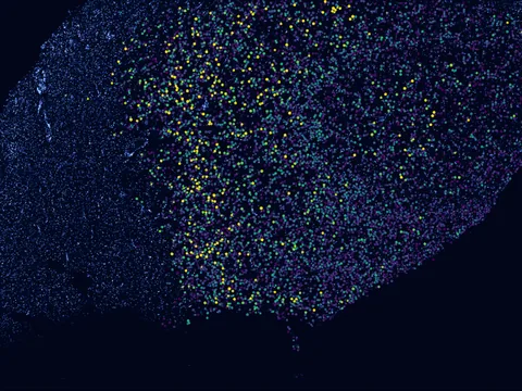 Human brain preview